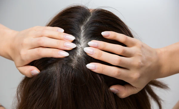 How to Resolve Persistent Hair Itching